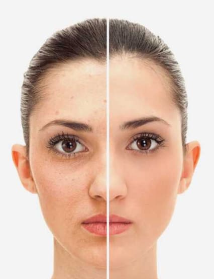 http://www.phoenixcosmeticcentre.com/facelift-anti-aging-